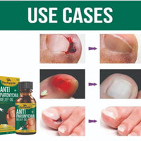 Anti Paronychia Relief Oil 20 ml Pack of 2